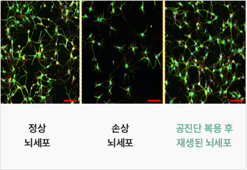 정상 뇌세포와 손상 뇌세포 공진단 복용 후 정상 뇌세포처럼 재생된 뇌세포 비교